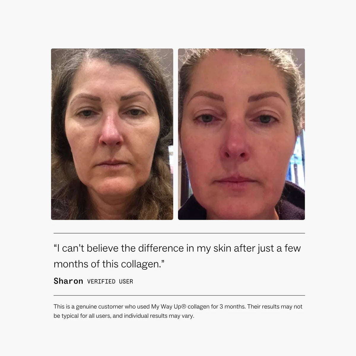 Collagen Restore