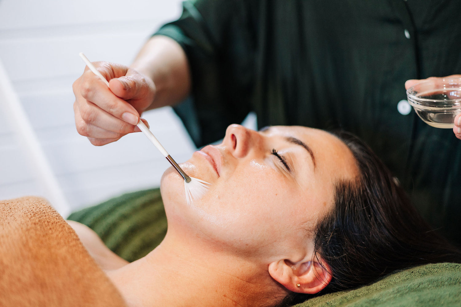 Lady relaxing on bed getting a Chemical peel facial treatment